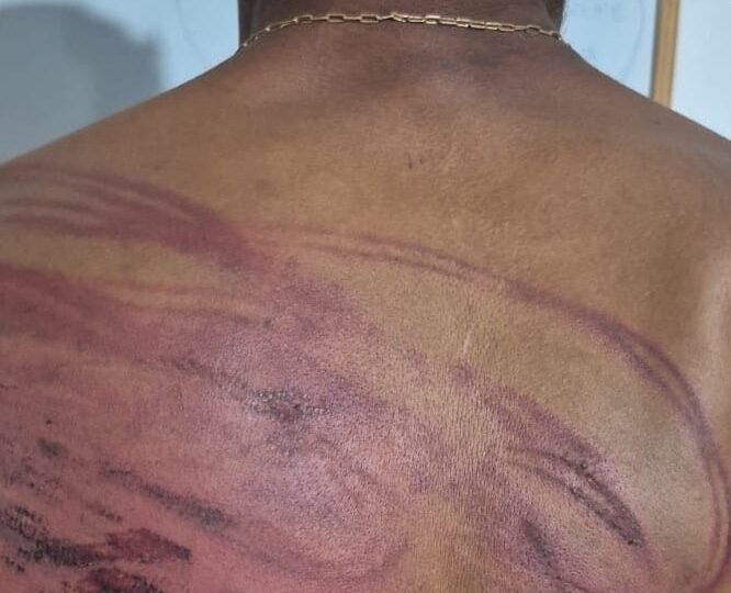 Faccionados torturam homem com mangueira e tentam degolá-lo em MT